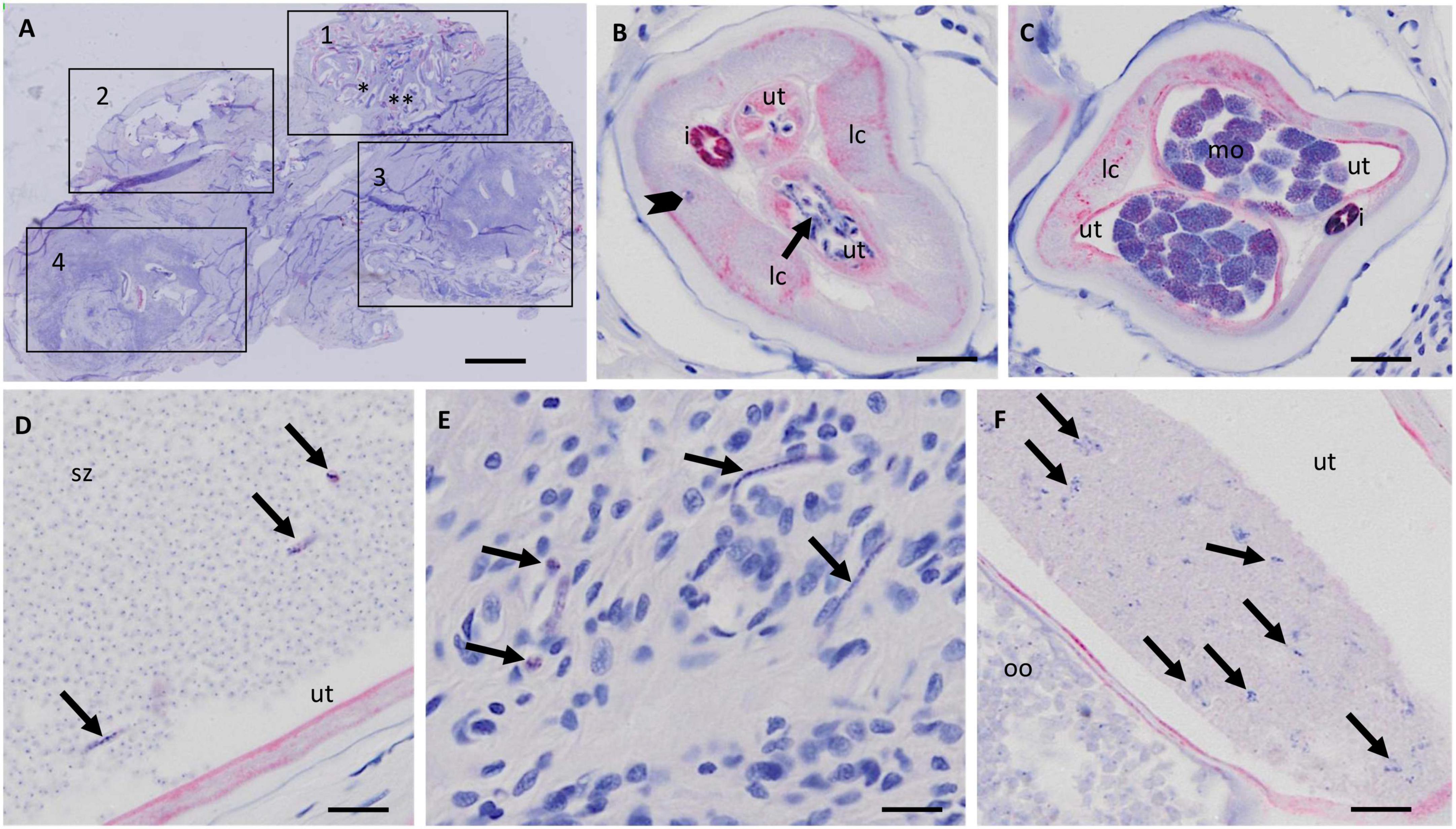 Histopathological evaluation of Onchocerca volvulus nodules by microscopy and by digital image analysis for the study of macrofilaricidal drug efficacy